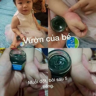 Dầu thoa muỗi cho bé .