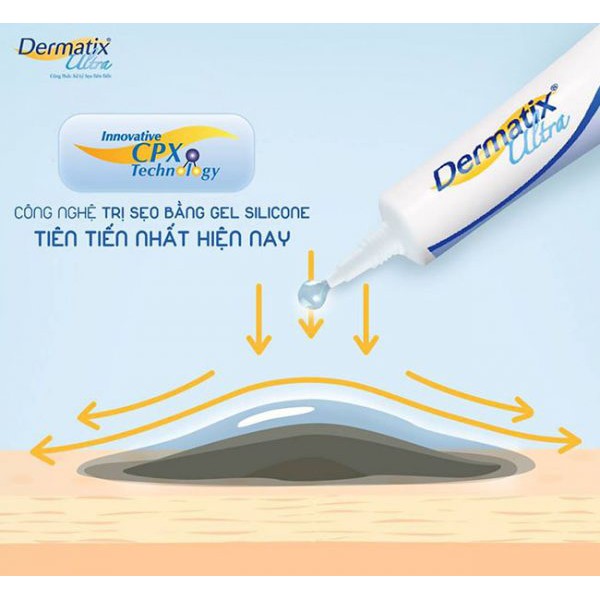 Kem mờ sẹo Dermatix Ultra tuýp 15g 7g nhập khẩu USA - làm phẳng và mờ sẹo lồi, sẹo thâm, sẹo phì đại, nám rạn da