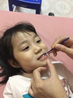 Vecni flour. Phòng ngừa sâu răng