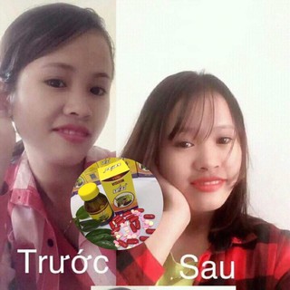 Vitamin Tăng Cân Thái Lan