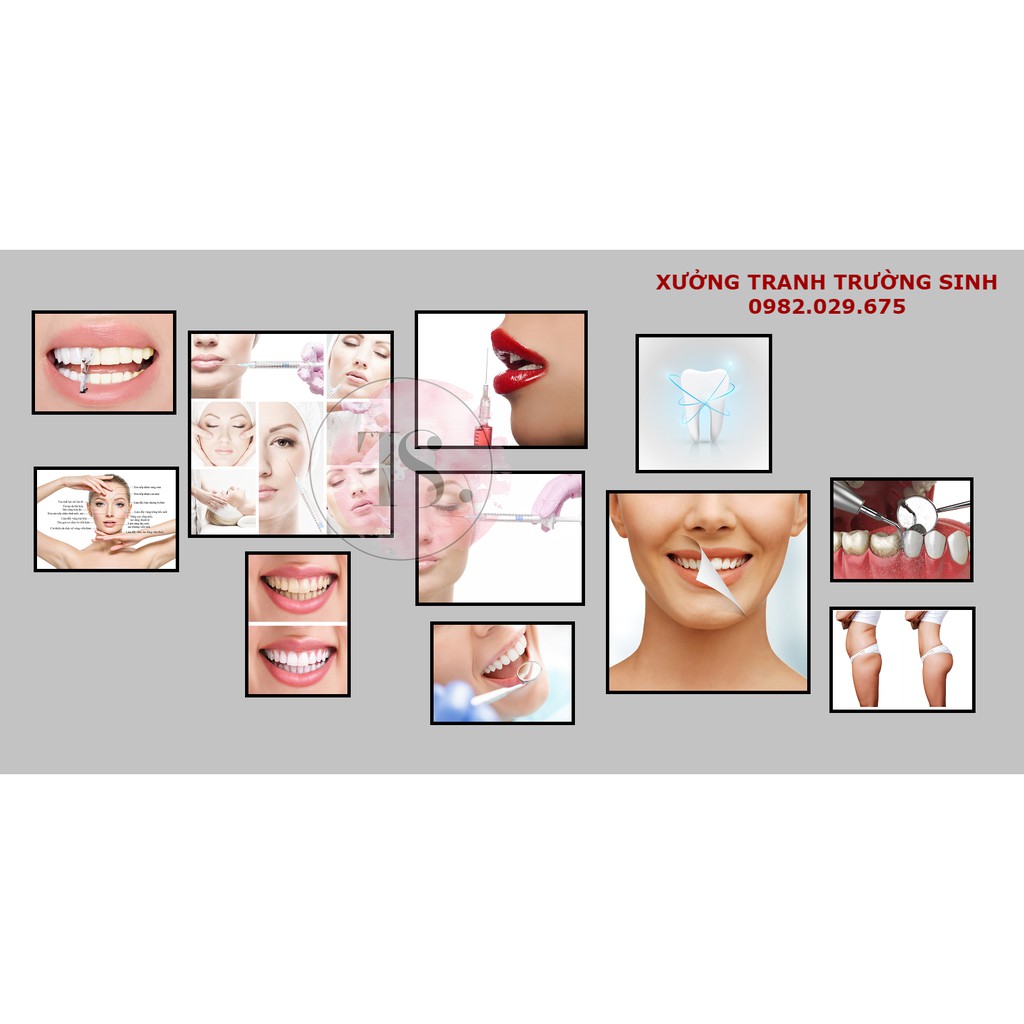 BỘ 11 TRANH TẤM CỨNG DÁN TƯỜNG (FILLER+NHA KHOA)
