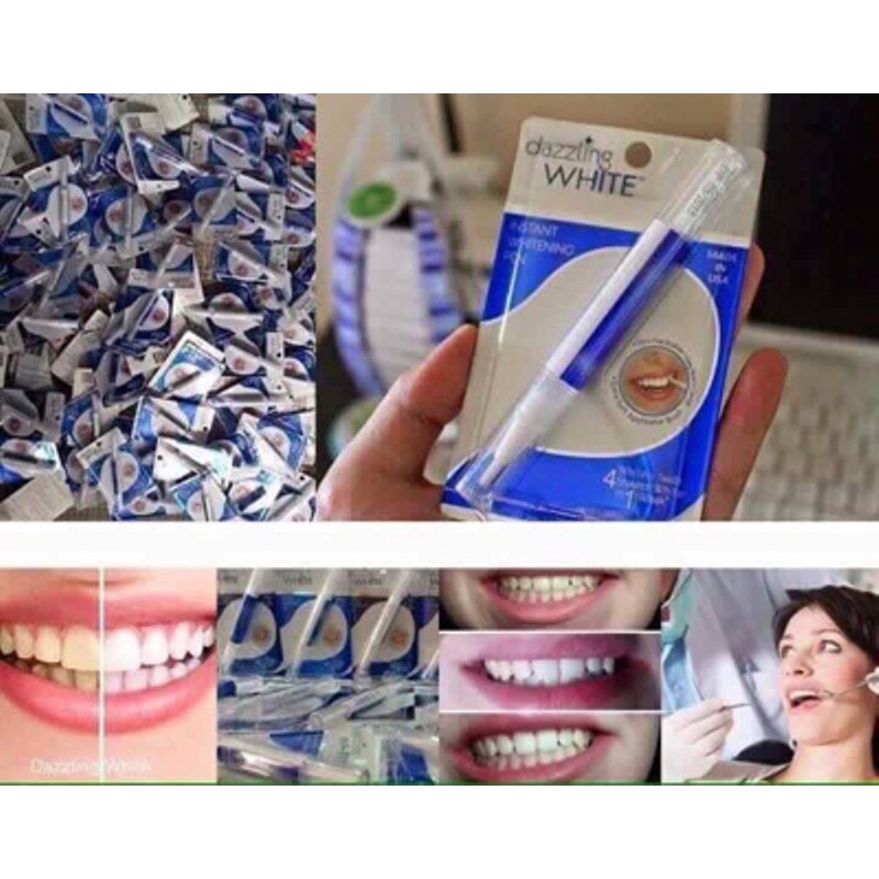 Bút tẩy trắng răng Dazzling White