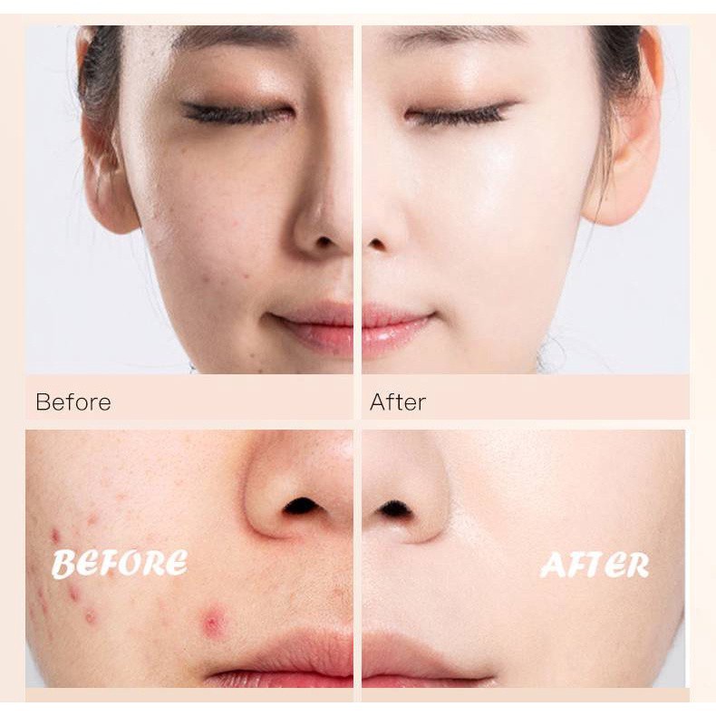 [Hàng mới về] Kem Che Khuyết Điểm Yangmei 3 Màu Sắc Tùy Chọn 2.7g