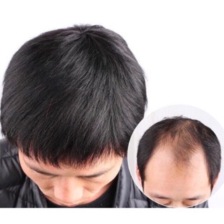 Tóc giả che hói nam