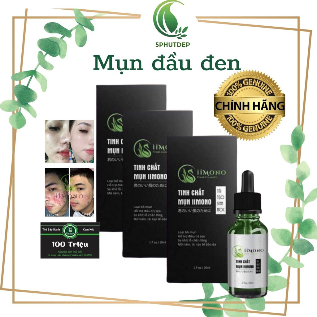 Ngừa mụn đầu đen IIMONO | BigBuy360 - bigbuy360.vn