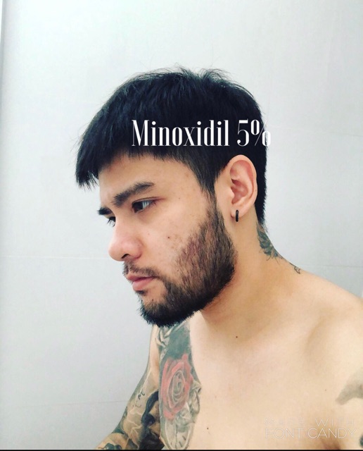 THUỐC MỌC TÓC VÀ RÂU MINOXIDIL 5%