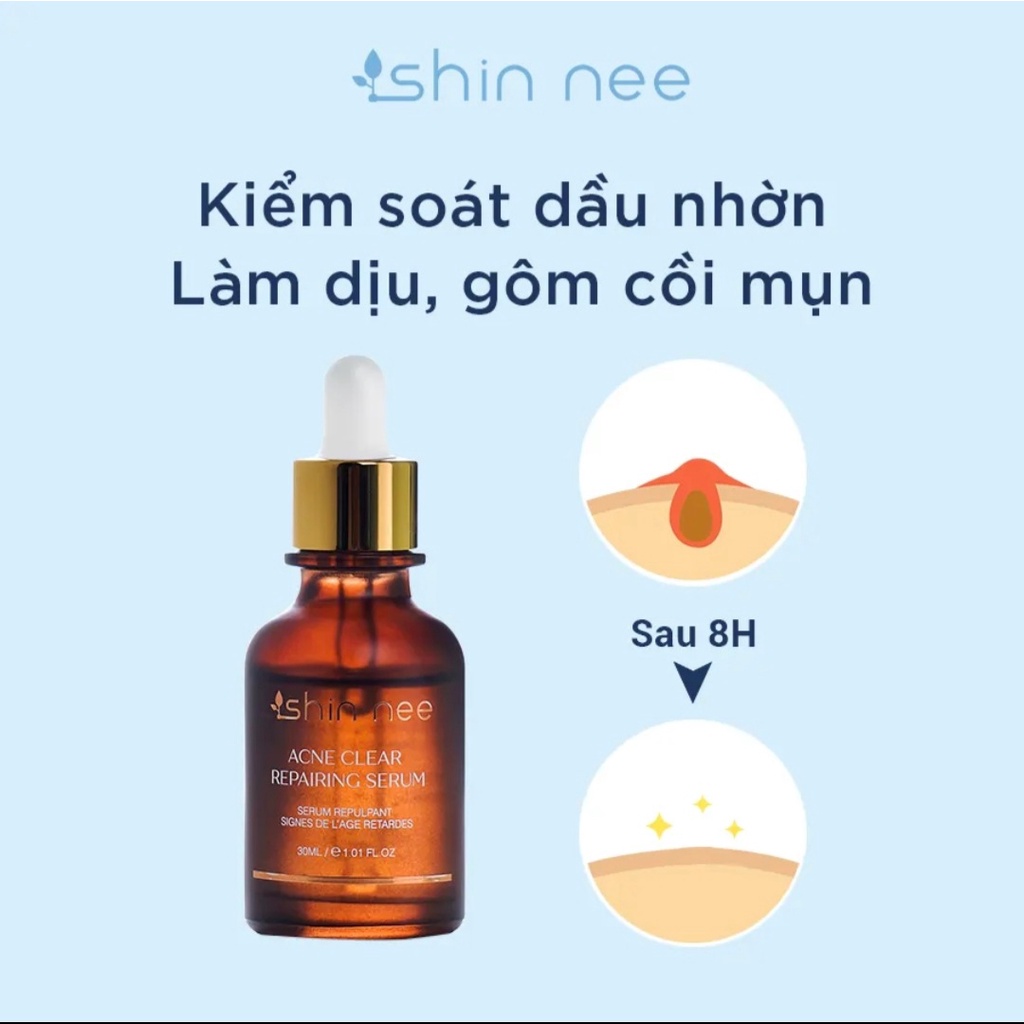 Tinh chất giảm mụn ngừa thâm cấp ẩm- Serum Acne Repairing Shin Nee - 35ml