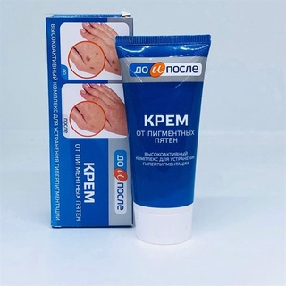 Kem Dưỡng Da Tay Đồi Mồi Kpem Koppektop Apteka Nga 50ml