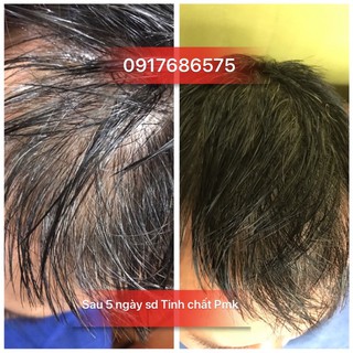 Tinh chất mọc tóc cao cấp Minh Khang