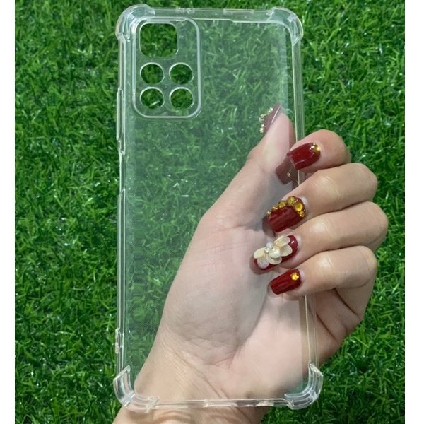 Ốp chống va đập Xiaomi Redmi Note 11 5G /Redmi Note 11 Pro 5G bảo vệ camera