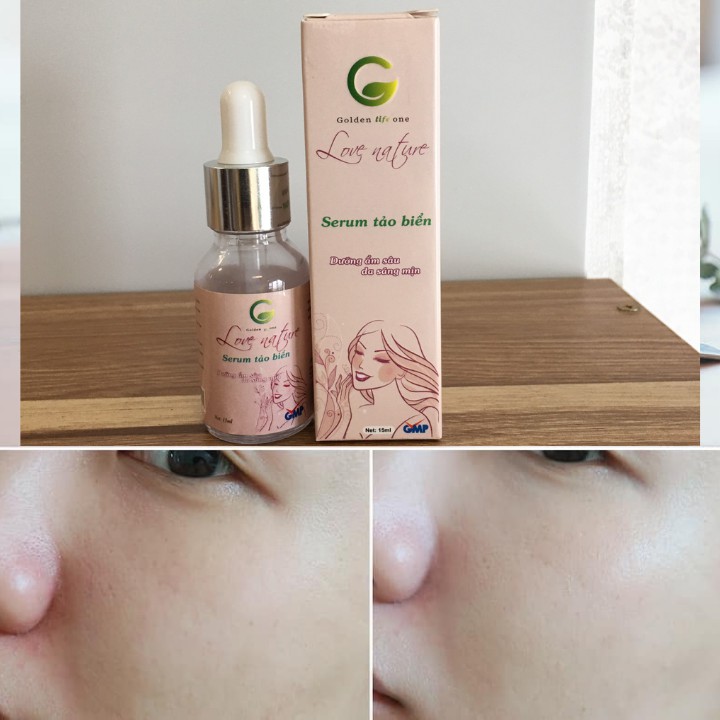 [CHÍNH HÃNG] Kem dưỡng trắng da thông thoáng lỗ chân lông ngừa thâm và mụn Serum tảo xoắn Love Nature