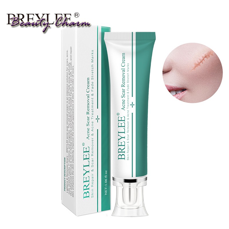 [Hàng mới về] Kem Hỗ Trợ Giảm sẹo 30ml chuyên dụng | BigBuy360 - bigbuy360.vn