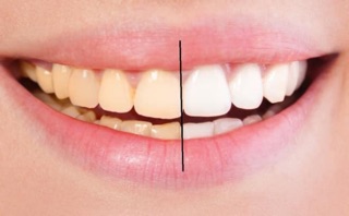 Kem Đánh Răng MUỐI- HỒNG SÂM- THẢO DƯỢC