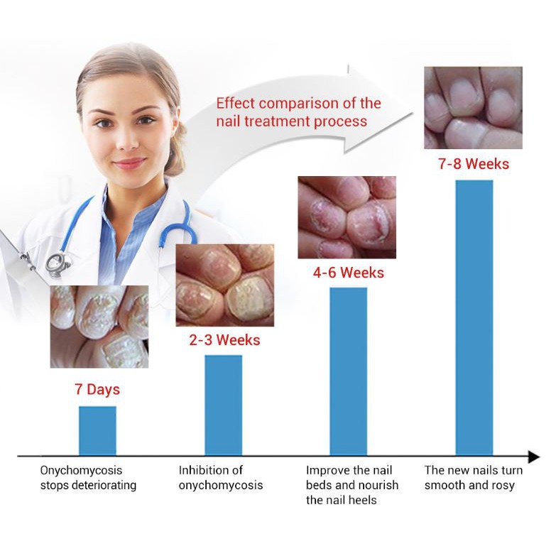 Serum Lanbena Phục Hồi Móng Tay Chân Chống Nấm - Nuôi Dưỡng Tái Tạo Móng EN