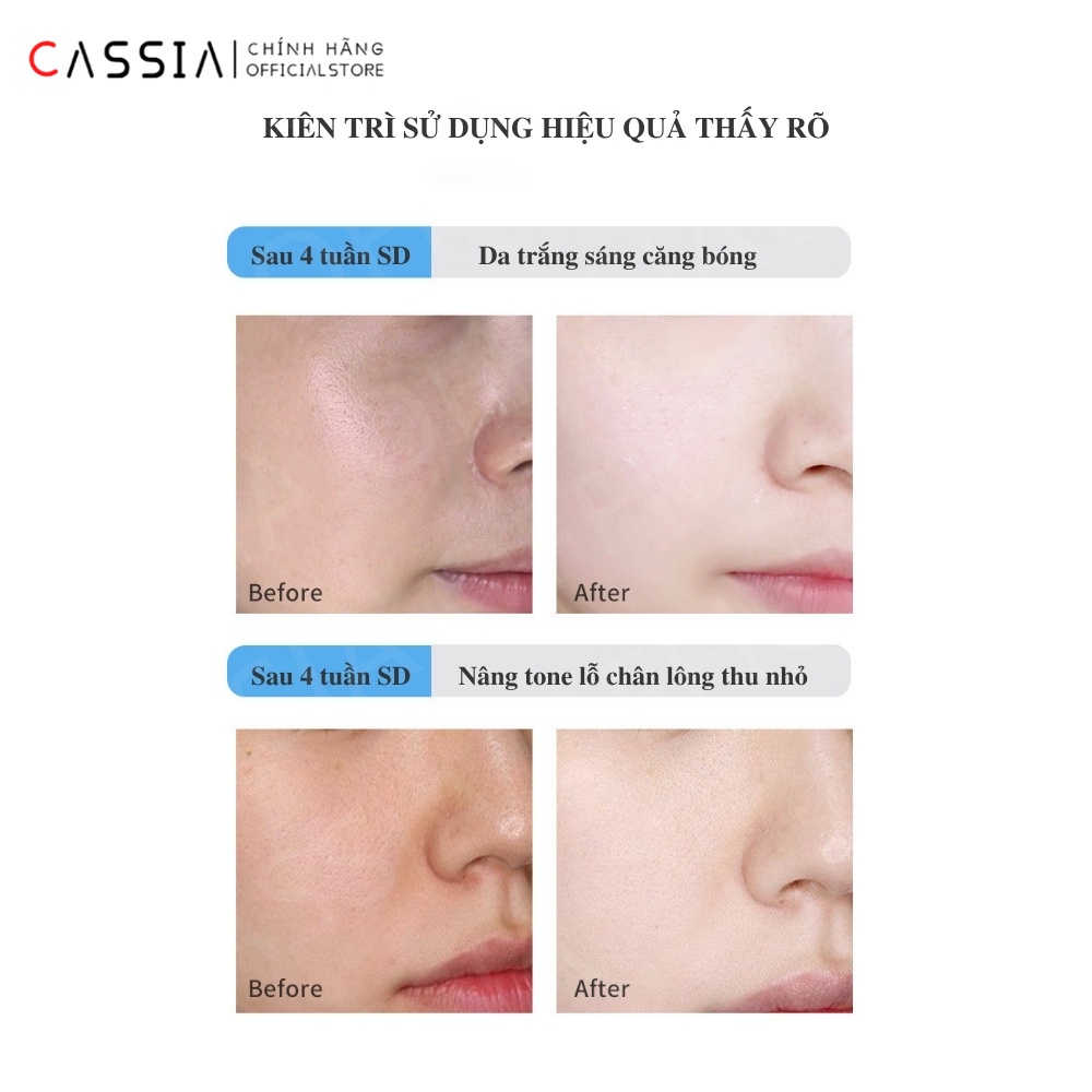 Mặt Nạ Gel Collagen Dưỡng Ẩm Cấp Nước, Làm Sạch Giảm Mụn, Dưỡng Trắng Da, Se Khít Lỗ Chân Lông, Tái 