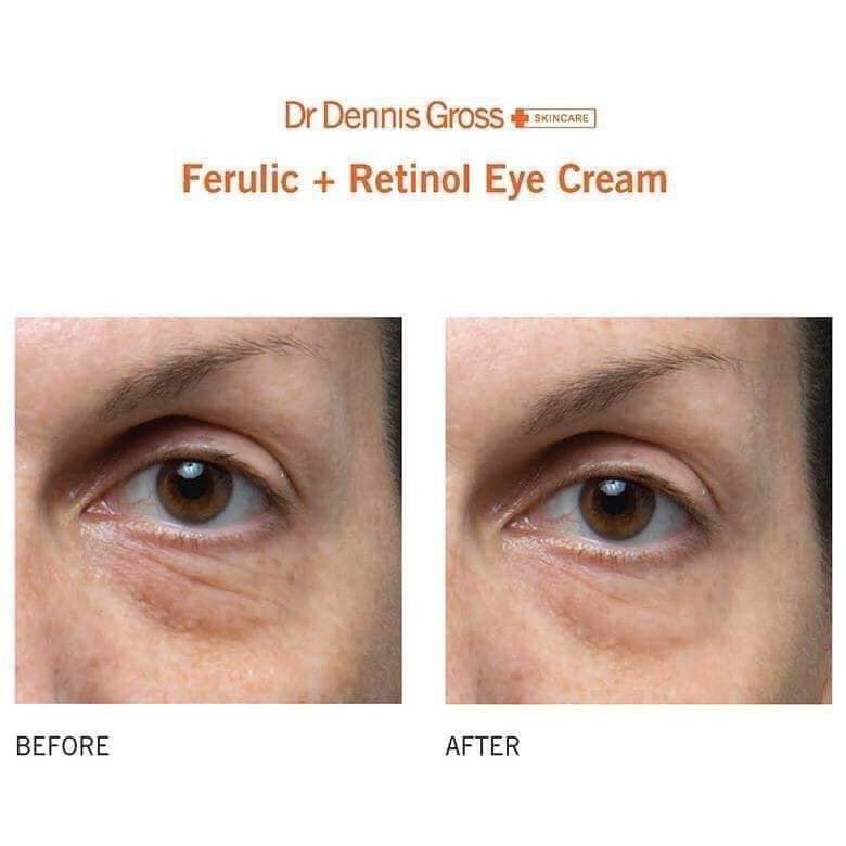 Serum mắt giảm nhăn, quầng thâm DR. DENNIS GROSS Advanced Retinol + Ferulic Triple Correction Eye Serum15ml fullbox