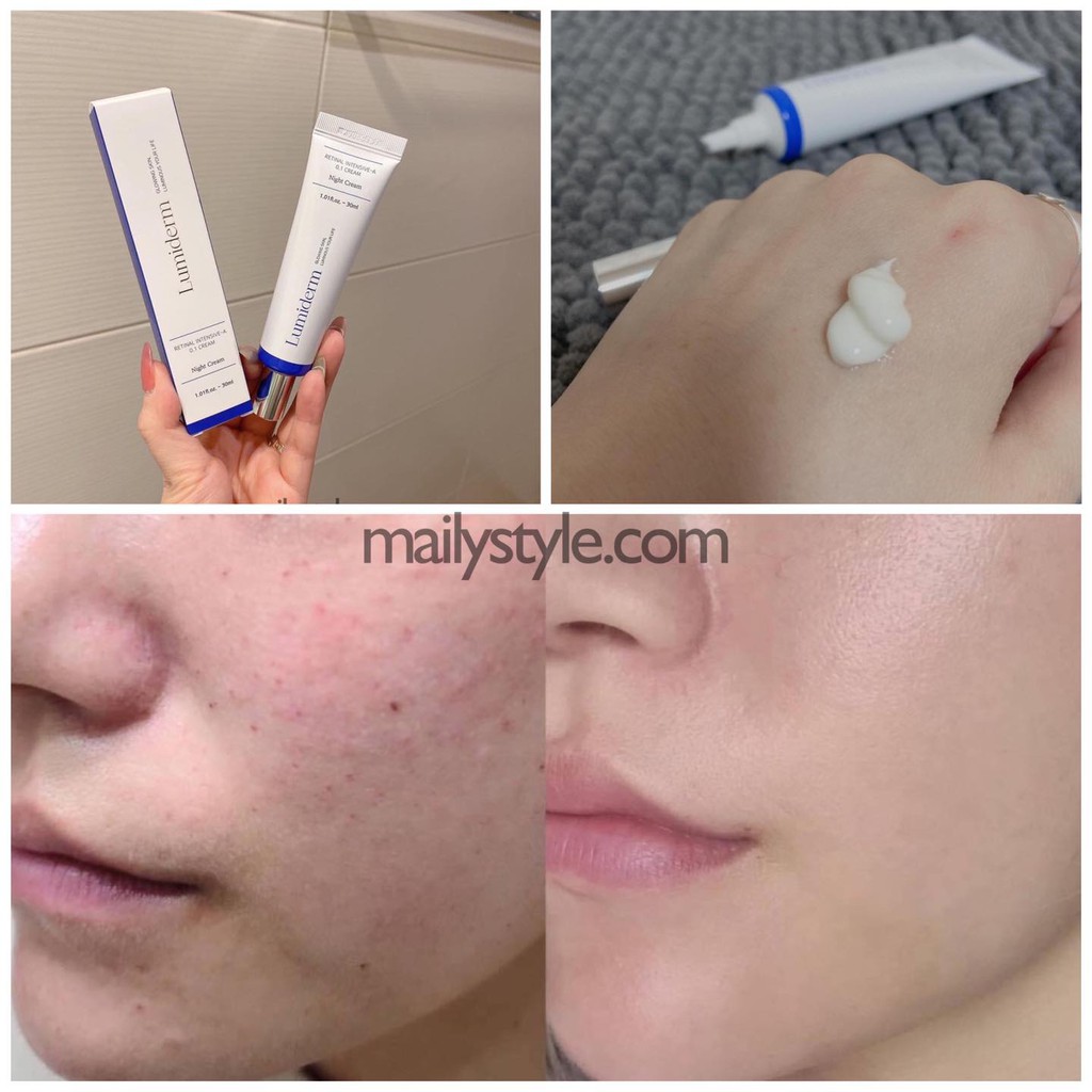 Q18_Kem Retinal 0,1% Lumiderm màu XANH