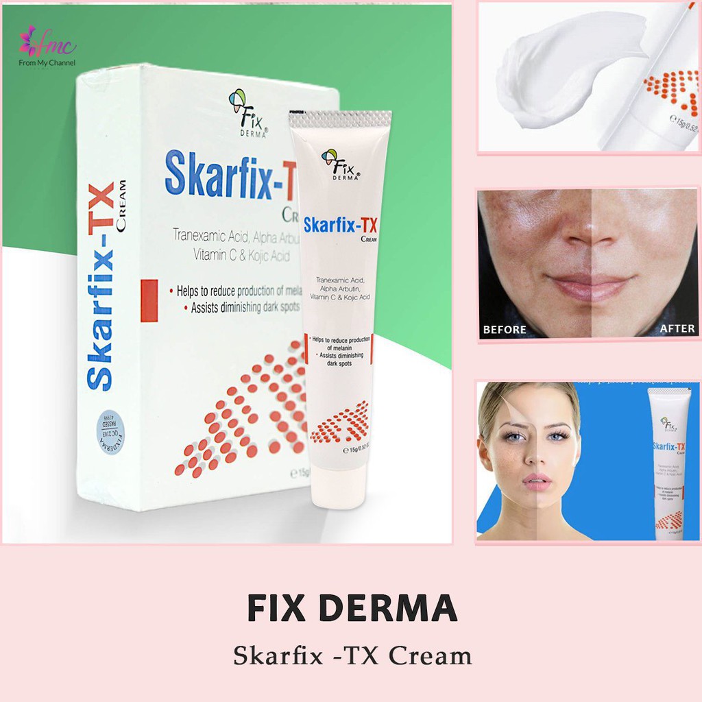 Kem dưỡng Skarfix Plus Cream & SkarfixTX 15g + Tặng 1 túi chườm giảm đau bụng