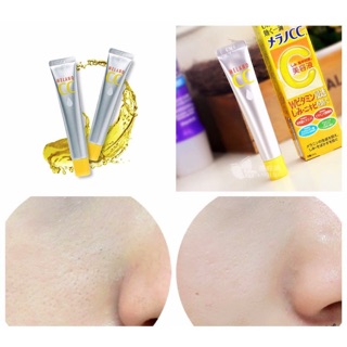 Serum vitamin c
