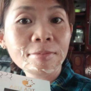 PEEL THAY DA MẶT TCA_USA