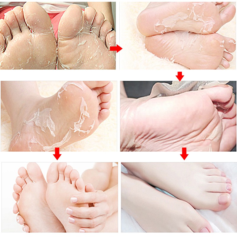 Mặt nạ chân Efero dạng lột để tẩy tế bào chết tiện lợi