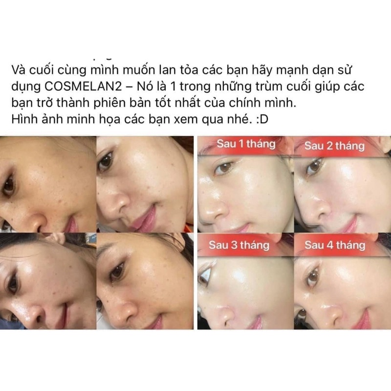 Kem Dưỡng Mờ Nám Tàn Nhang Mesoestetic Cosmelan 2