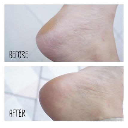 Kem bôi nứt gót châŋ làm mềm da HEELSPA Foot Care Cream