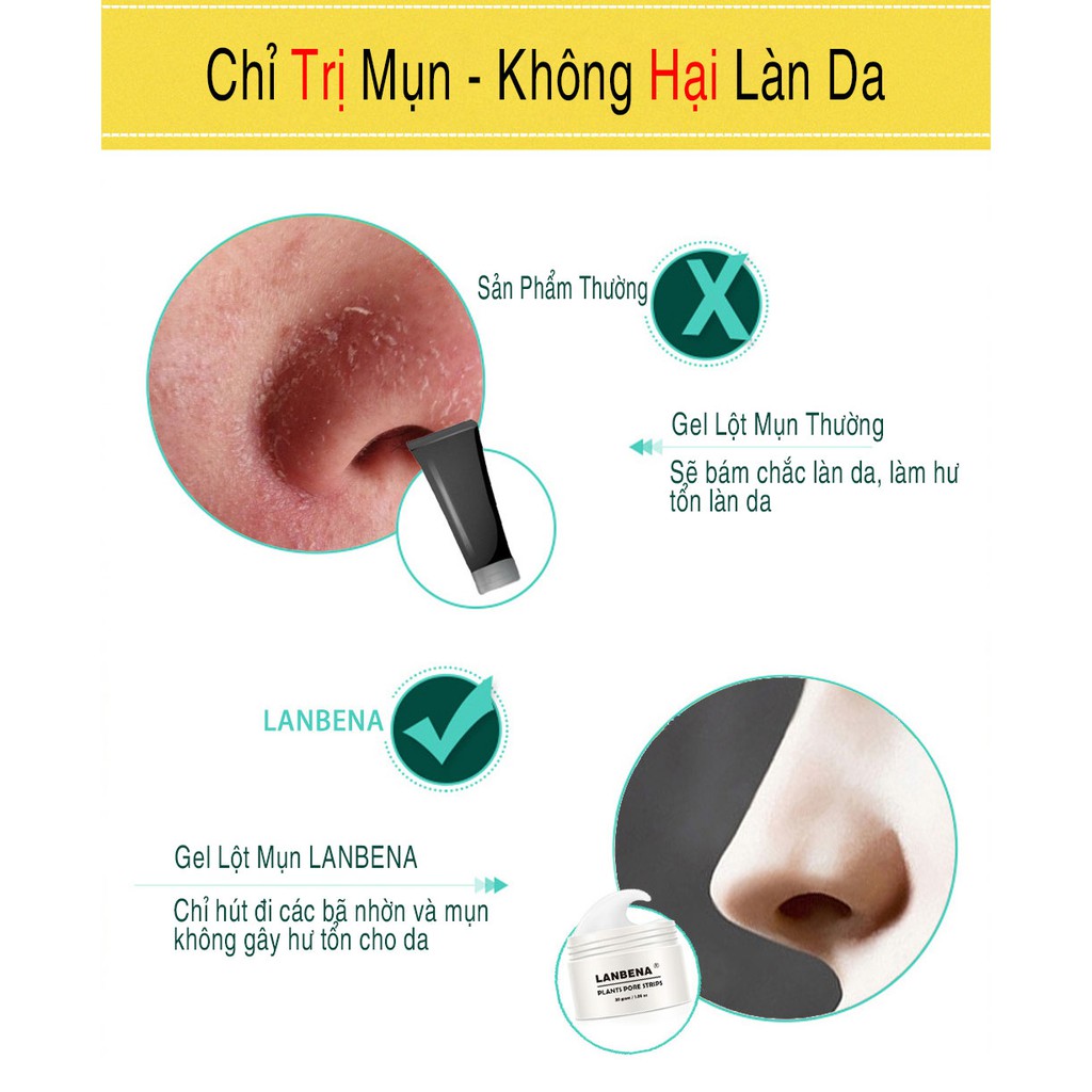 [CHÍNH HÃNG] LANBENA Gel Lột Mụn Đầu Đen Hộp Trắng Ngăn Ngừa Và Loại Bỏ Mụn Cám Làm Sạch Da Thu Nhỏ Lỗ Chân Lông 30g