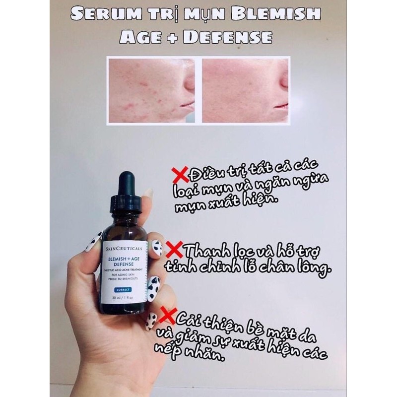 Serum ngăn ngừa và giảm mụn và chống lão hoá Skinceuticals blemish + age defense - Chính hãng