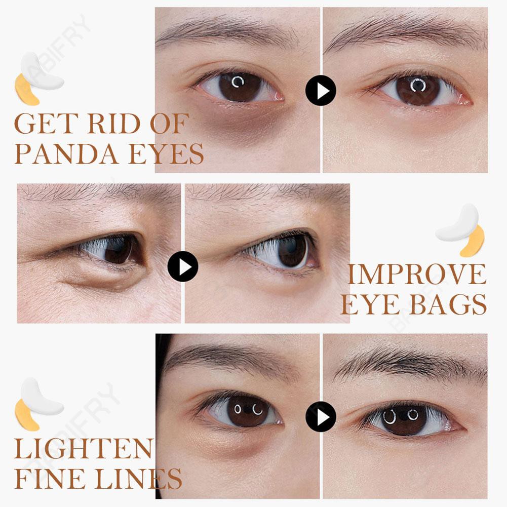 (Hàng Mới Về) Set 2 Mặt Nạ Mắt Collagen Loại Bỏ Quầng Thâm Và Bọng Mắt | BigBuy360 - bigbuy360.vn