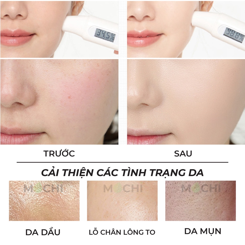 Mặt Nạ Ngủ Dưỡng Da Cấp Ẩm Cân Bằng Dầu Trẻ Hóa Mask Nicotinamide KDK Nội Địa MOCHI SHOP Nhau Thai Cừu l Rau Má