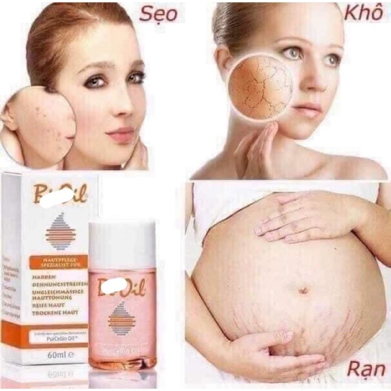 Gel trị rạn Bio oil