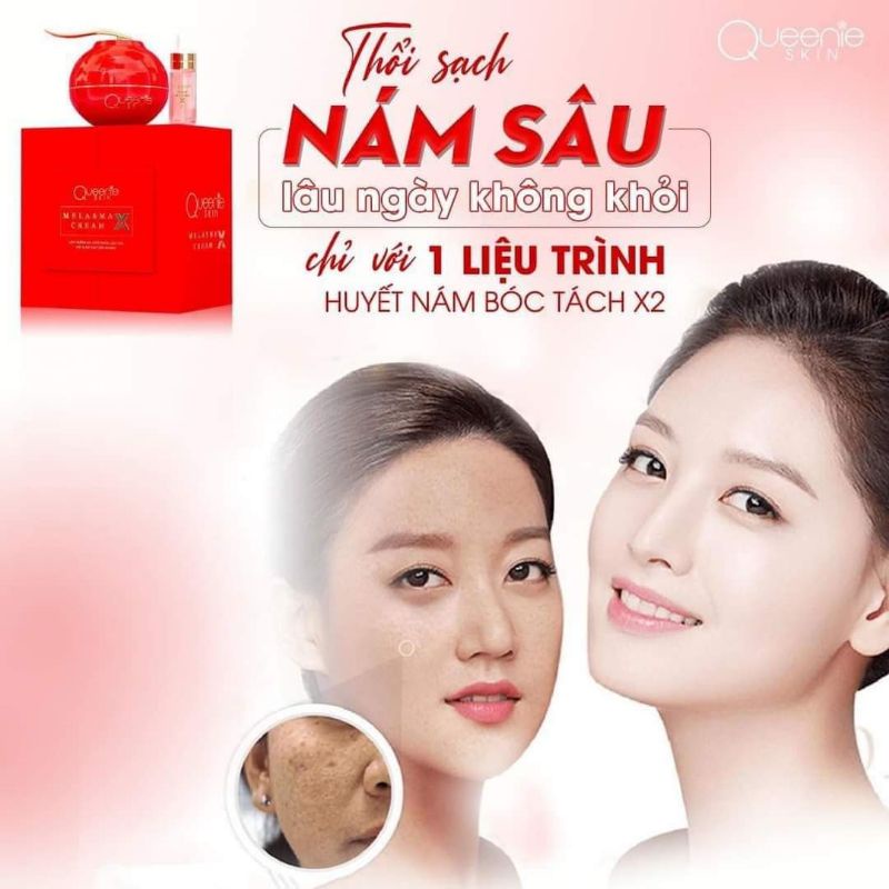 Kem nám Queenie Skin Phiên bản mới X2