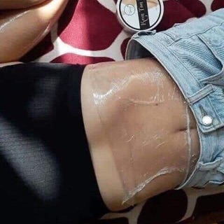 Kem Tan Mỡ Cenly