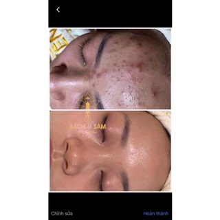 01 Bách Y Sâm - Nhất Mộc Hương
