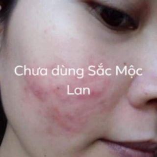 SẮC MỘC LAN