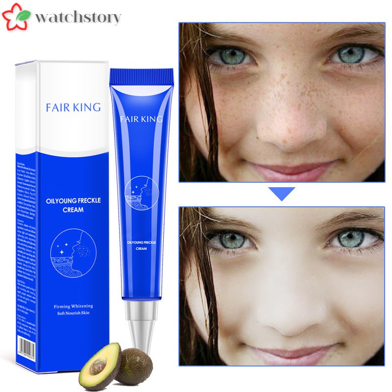 (Hàng Mới Về) Kem Trị Tàn Nhang Vết Thâm Làm Trắng Da 20g | BigBuy360 - bigbuy360.vn