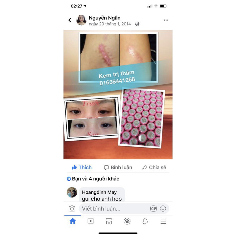 (Mẫu mới 25gr) Kem thâm dầu cá, mờ vết thâm mụn, thâm muỗi.... mới hàng chuẩn công ty chính hãng | BigBuy360 - bigbuy360.vn