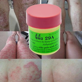 Kem dưỡng da chân chống nấm mốc 14g chất lượng cao