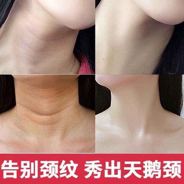 Kem masaage cổ cằm | BigBuy360 - bigbuy360.vn