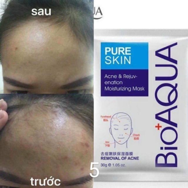 Mặt Nạ Dưỡng Trắng Pure Skin 🌿𝑭𝒓𝒆𝒆𝒔𝒉𝒊𝒑🌿 Xóa Tan Mụn BioAQUA - Sạch Nhờn, Hết Mụn Mặt Nạ Dành Cho Da Dầu Mụn | BigBuy360 - bigbuy360.vn