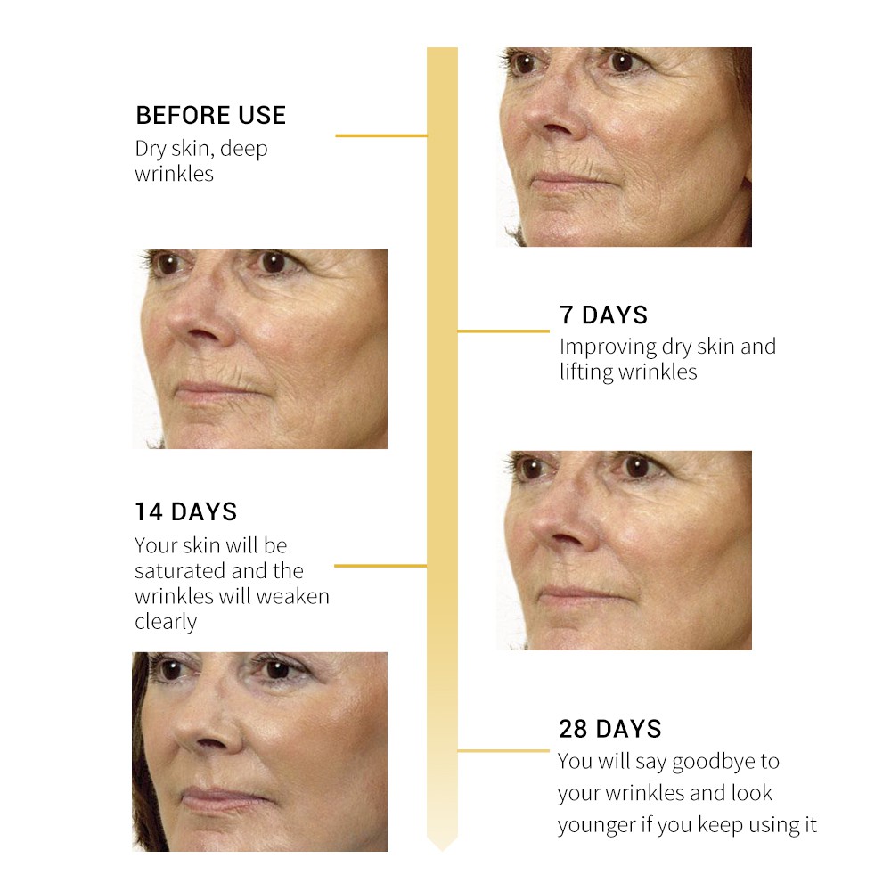Set 3 Serum Retinol BREYLEE Giúp Da Săn Chắc Và Chống Nếp Nhăn Hiệu Quả