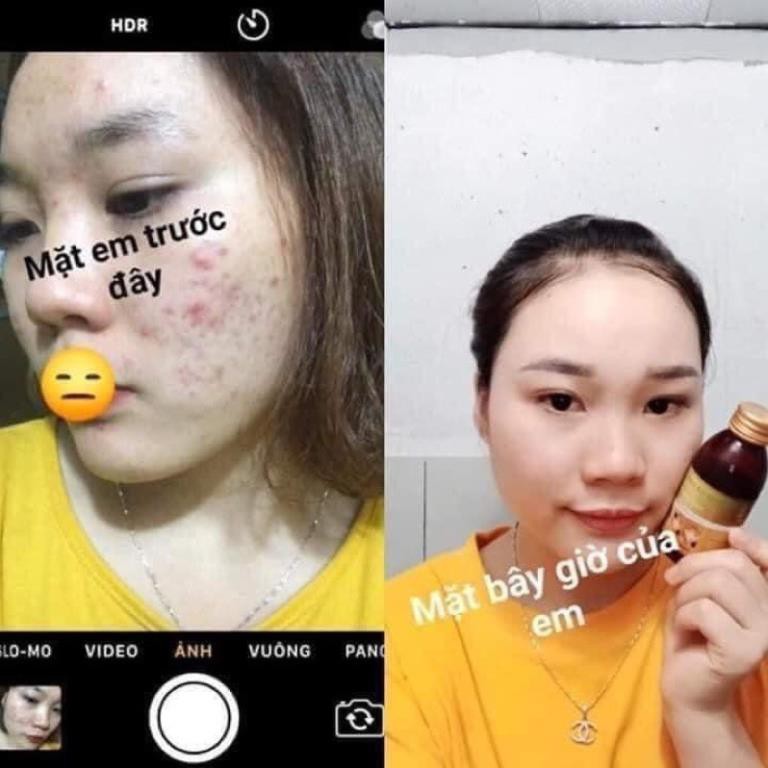 Tinh chất mụn Lê Xuân handmade 130ml | BigBuy360 - bigbuy360.vn