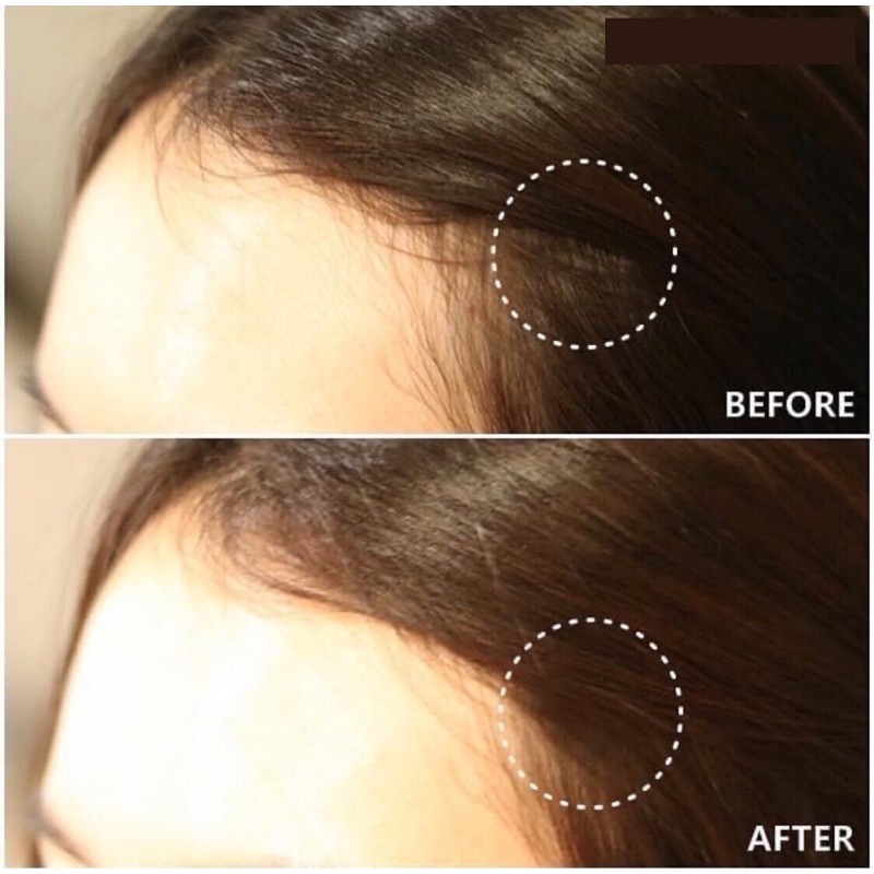 Viên Uống Biotin Zin C Men Bia Hữu Cơ Đức Siêu Hiệu Quả Trong Việc Kích Thích Mọc Tóc Làm Dày Chắc Khỏe Tóc Móng Tay | BigBuy360 - bigbuy360.vn