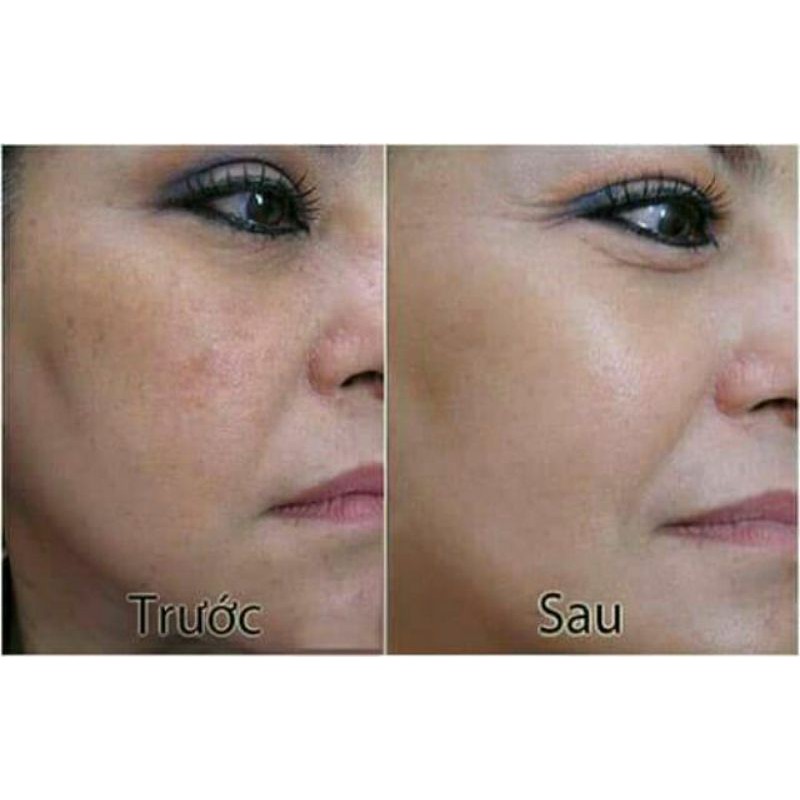 NGÀY VÀ ĐÊM CLOBETAMIL G CAO CẤP