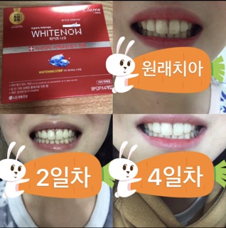 Miếng làm trắng răng Claren LG Hàn Quốc