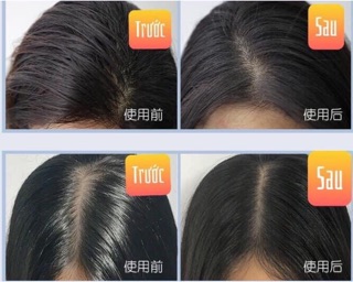 [HÀNG SẴN] DẦU GỘI KHÔ ISSY