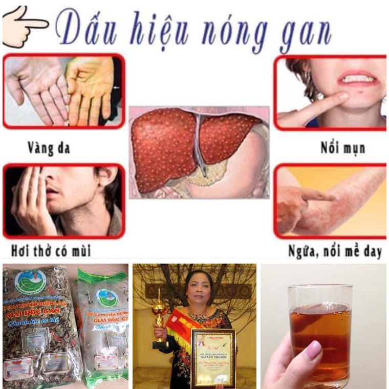 Trà mát gan Đường Giai Lương Y Nguyễn Thị Hội