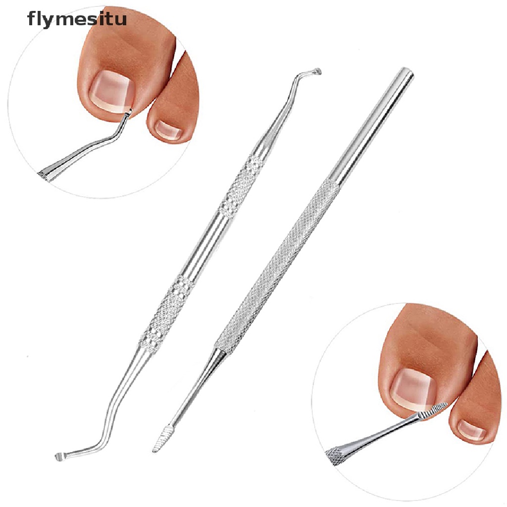 Fesu Foot Nail Correction Fixer Nail Pedicure Tool Paronychia Treatments Foot Care .