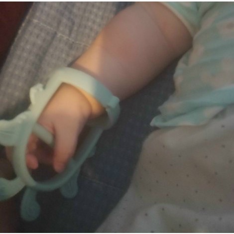 Gặm nướu Barot [Tặng kèm hộp đựng]